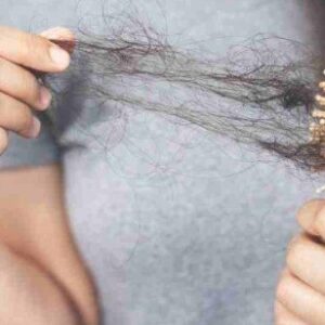 Arti Mimpi Rambut Rontok